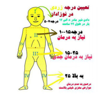 درجه طبیعی زردی نوزاد