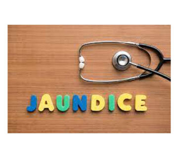 زردی فیزیولوژیک و پاتولوژیک
