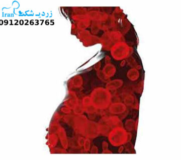 تاثیر مصرف قرص آهن در دوران بارداری بر زردی نوزاد