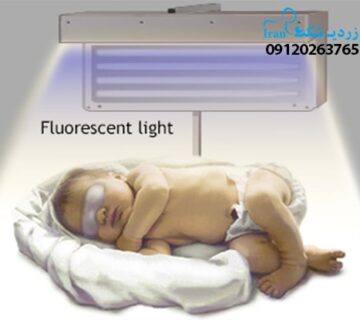 درمان زردی نوزاد در تهران