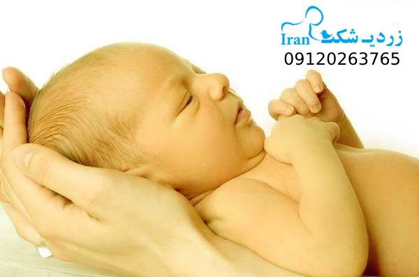 زردی نوزاد چیست