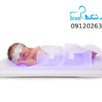 اجاره دستگاه زردی نوزاد: بهترین گزینه برای درمان زردی نوزاد