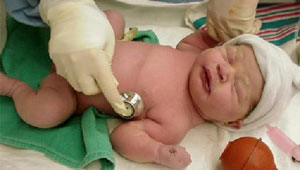 مدیریت و درمان سندروم کریگلر-نجار